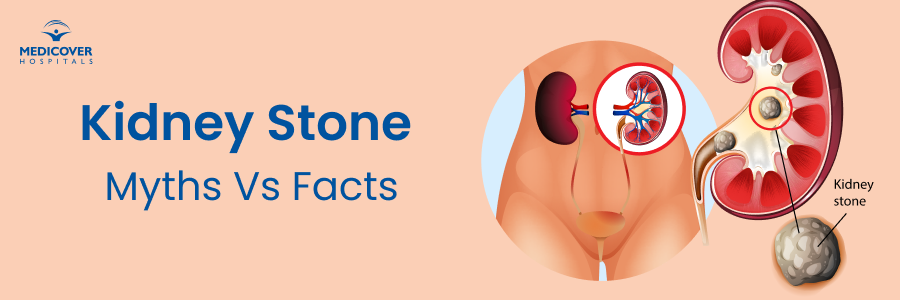 Kidney Stone Myths Kidney Stone Myths