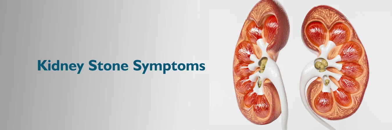 Kidney Stones Symptoms in Women