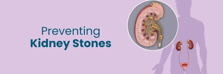 Preventing Kidney Stones Tips and Strategies
