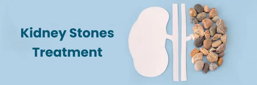 Kidney Stones Treatment in Begumpet