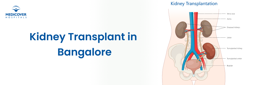Kidney Transplant in Bangalore