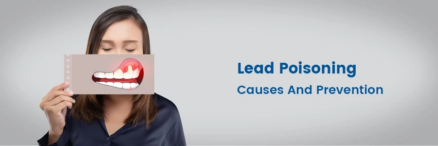 Lead Poisoning - Causes And Prevention