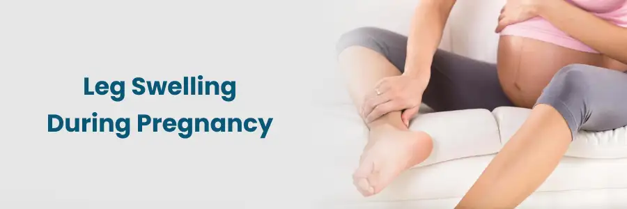 Leg Swelling During Pregnancy