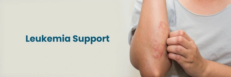 Leukemia Support Hyderabad