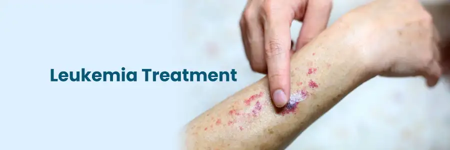 Leukemia Treatment Hyderabad