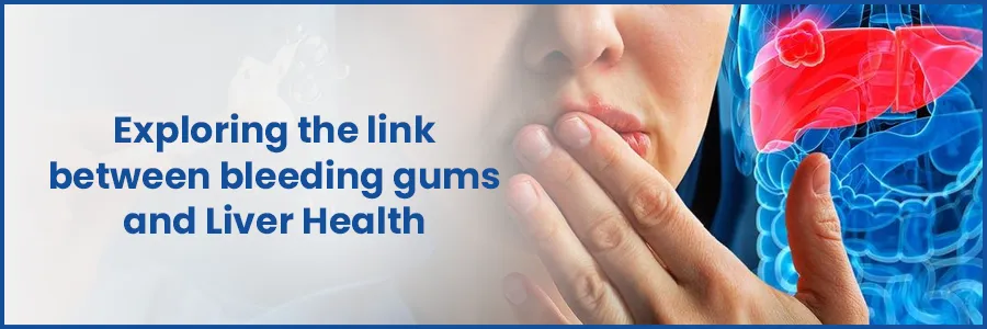 The Surprising Link: Exploring Bleeding Gums and Liver Health
