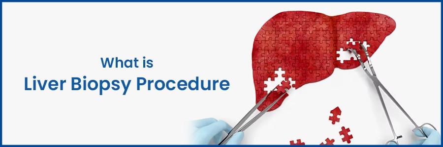 What is liver biopsy Procedure? [Steps & Cost]