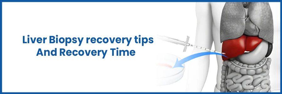 Best Liver Biopsy recovery tips And Recovery Time