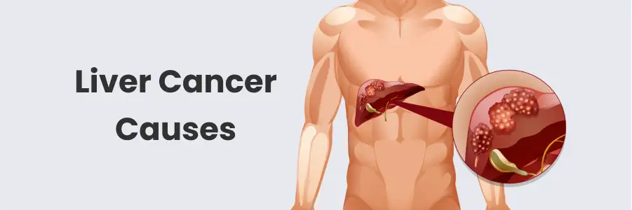 liver cancer causes
