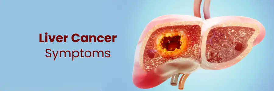 Liver cancer symptoms 