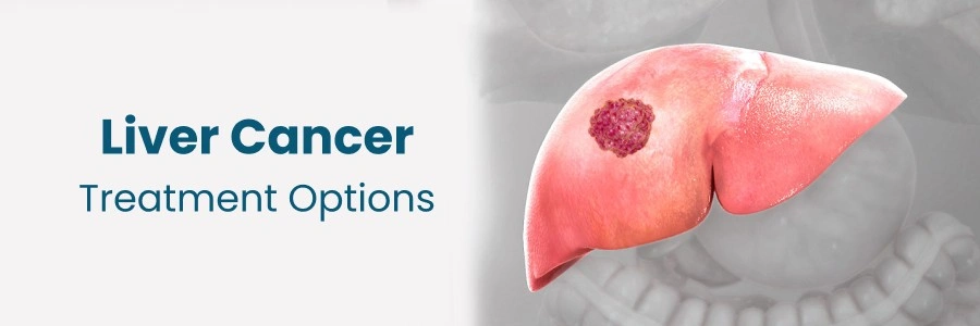 Liver cancer treatment options