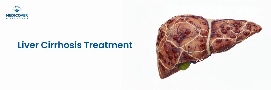 Cirrhosis of the Liver: What It Is and How to Manage It