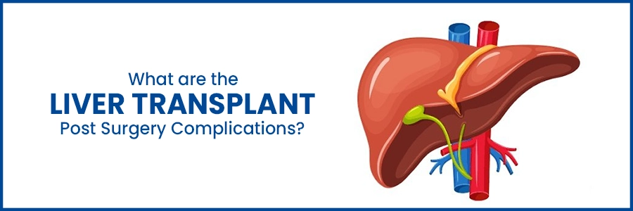 What are the Liver Transplant Post Surgery Complications?