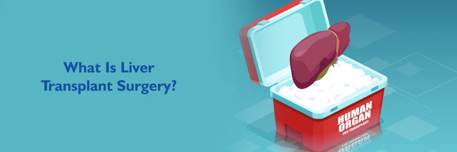 Liver Transplant Surgery