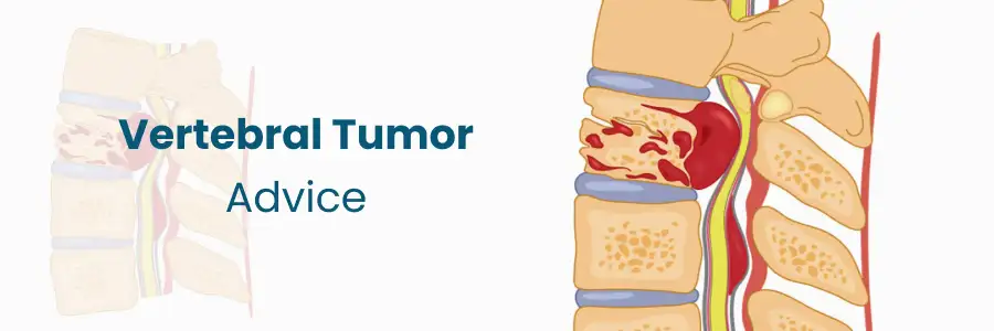 Living Well with Vertebral Tumors Medicover Hospitals