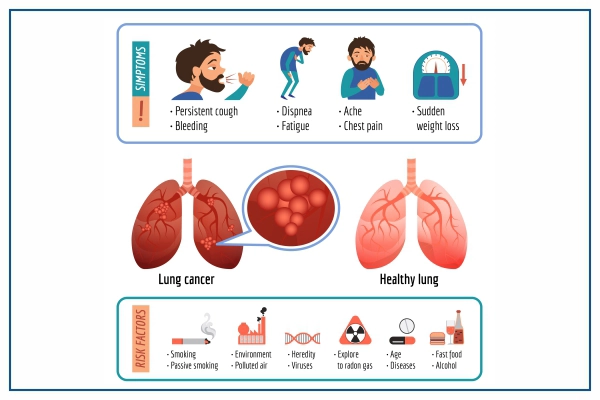 Maladie pulmonaire restrictive | Hôpitaux Medicover