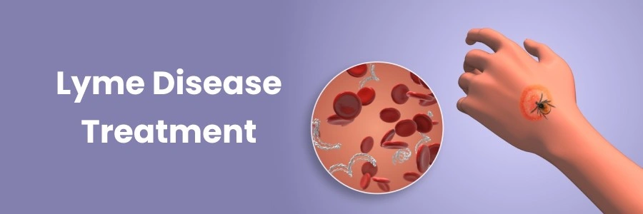 lyme disease treatment
