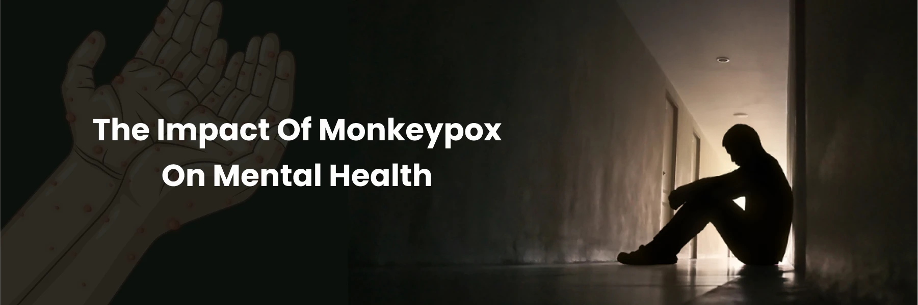 Monkeypox's Mental Health Impact: Effective Coping Strategies