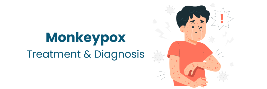Monkeypox Treatment and Diagnosis in Begumpet