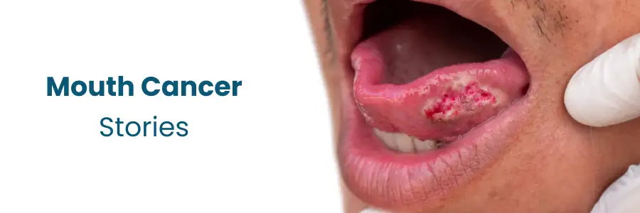 Mouth cancer survivor stories from Nellore at Medicover Hospitals