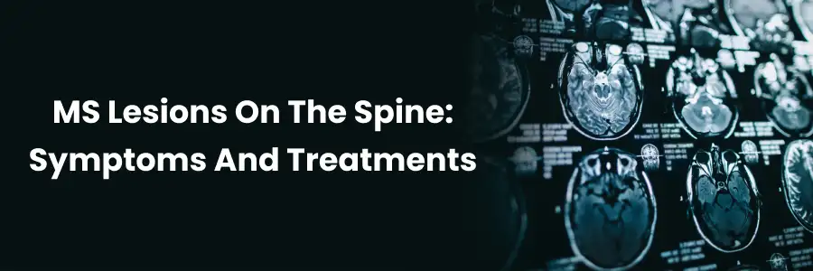 "Spinal MS Lesions: Symptoms & Treatments"