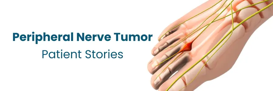 Nerve Tumor Patient Stories Hyderabad Nerve Tumor Patient Stories Hyderabad