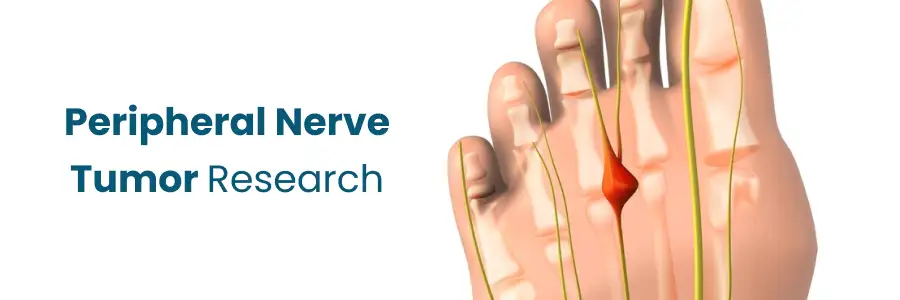 Nerve Tumor Research Vizag