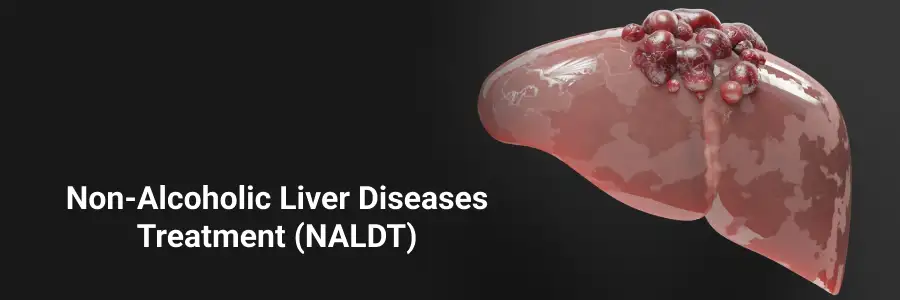 Non Alcoholic Liver Disease Treatment