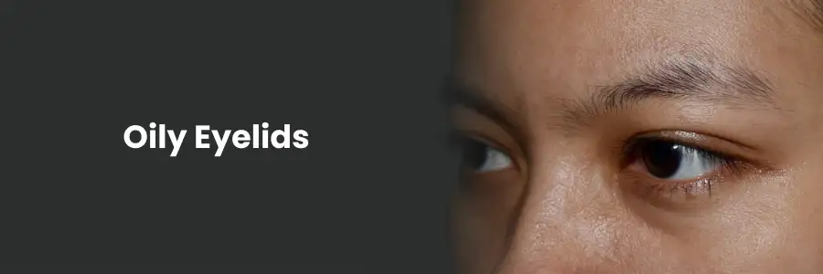 Causes and Treatments for Oily Eyelids