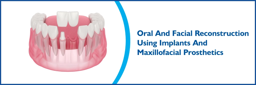 Oral And Facial Reconstruction Using Implants And Maxillofacial Prosthetics