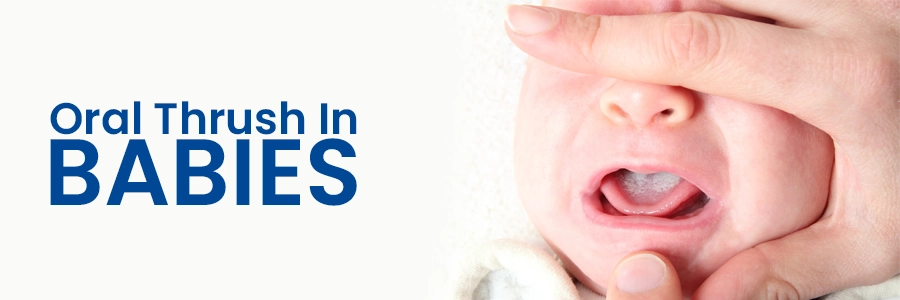 Oral Thrush In Babies