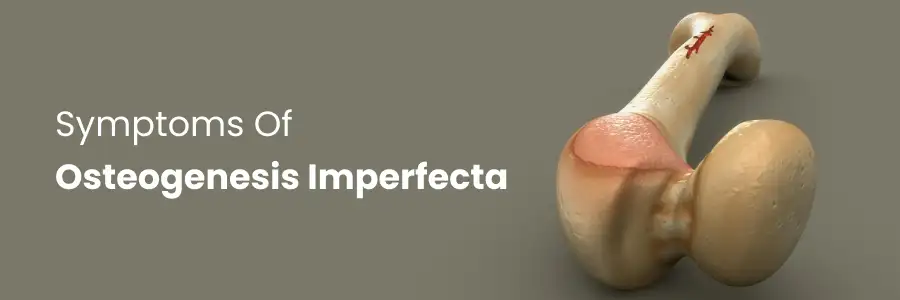 Osteogenesis Imperfecta Symptoms