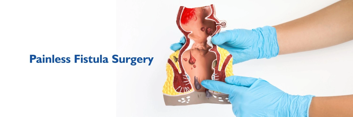 Painless Fistula Surgery With Minimum Stitches