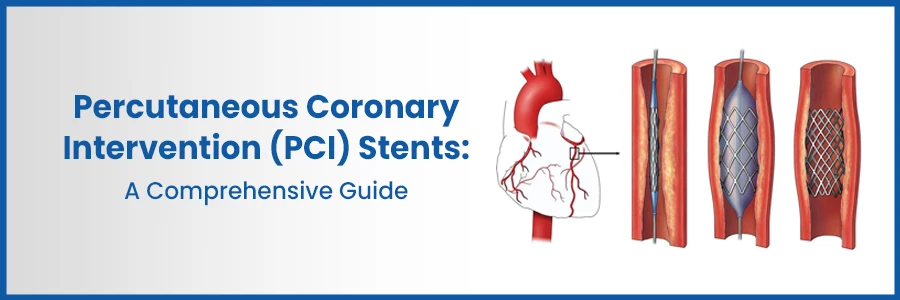 Percutaneous Coronary Intervention (PCI) Stents: Guide