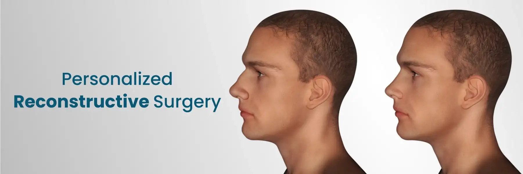 Personalized Reconstructive Surgery Hyderabad