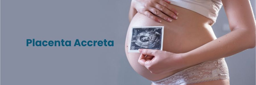 Placenta Accreta