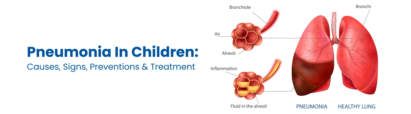 Pneumonia In Children
