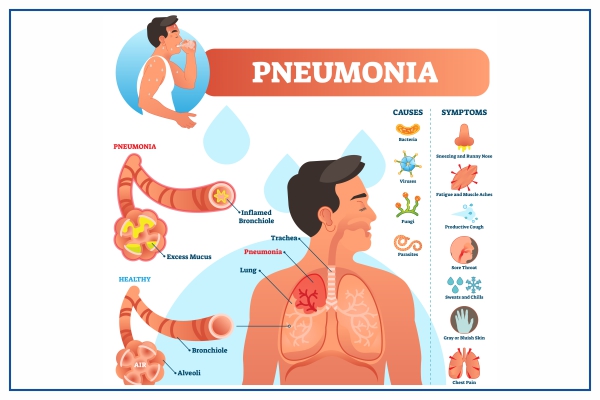 images/pneumonia
