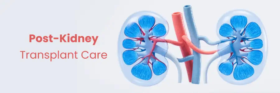 What Does Post-Kidney Transplant Care Involve and How to Manage It?