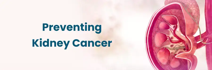 Preventing Kidney Cancer Tips