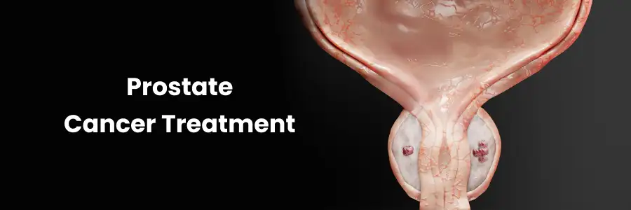 Prostate Cancer Treatment Hyderabad