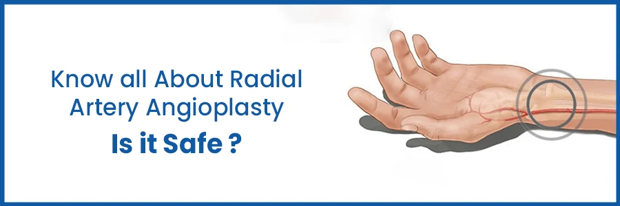Know all About Radial Artery Angioplasty - Is it Safe?