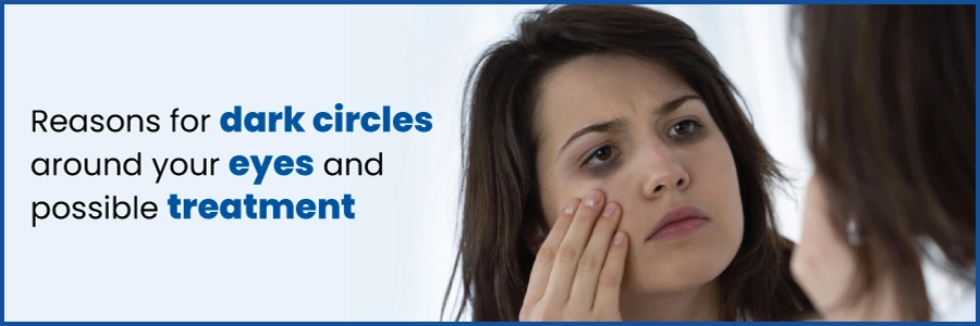 Reasons For Dark Circles Around The Eyes And Possible Treatment