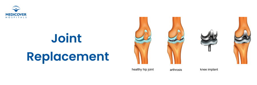 Restoring Movement with Precision: Advanced Joint Replacement and Orthopedic Care in Vizag