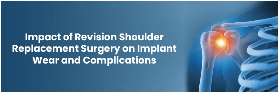 Impact of Revision Shoulder Replacement Surgery on Implant Wear and Complications