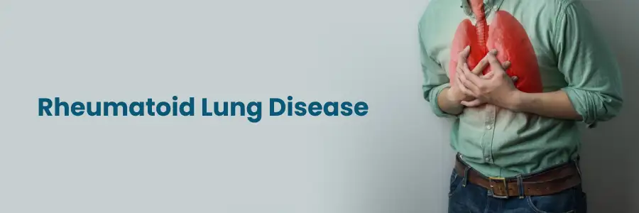 Effective Management of Rheumatoid Lung Disease