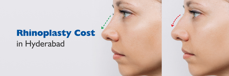 Rhinoplasty Cost in Hyderabad