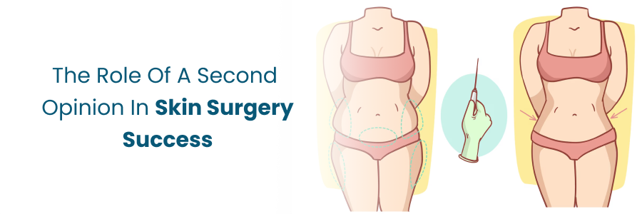 Second opinion role in skin surgery success