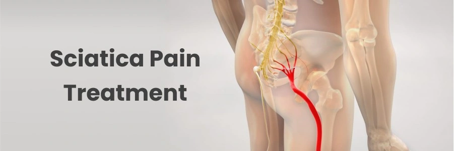 Sciatica Pain Treatment