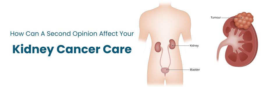 Second Opinion on Kidney Cancer Care